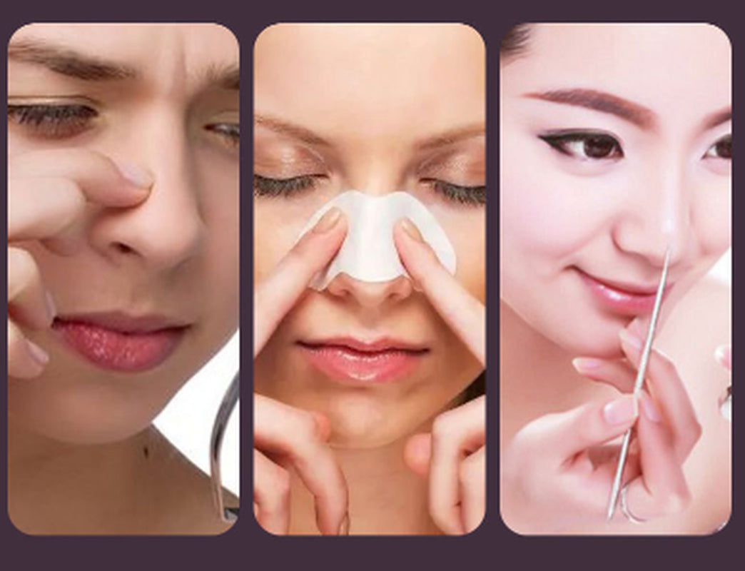 Visual Blackhead Acne Remover to Suck Blackheads