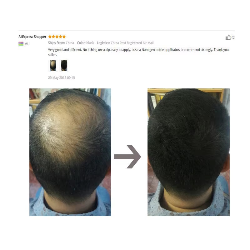 Hair Fibers Regrowth Powders Black Volumizing Hair Fibers Hair Building Fiber Natural Keratin Hair Styling Thickening Powder