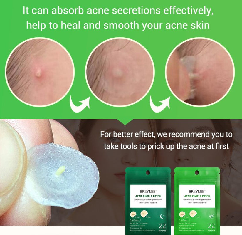 Tea Tree Acne Patch Fades Acne Marks and Ultra-Thin